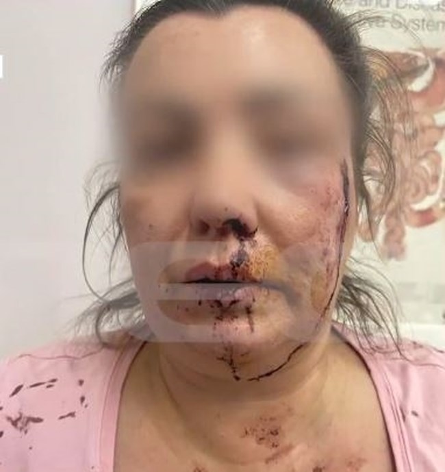 ΑΙΓΑΛΕΩ ΖΕΥΓΑΡΙ