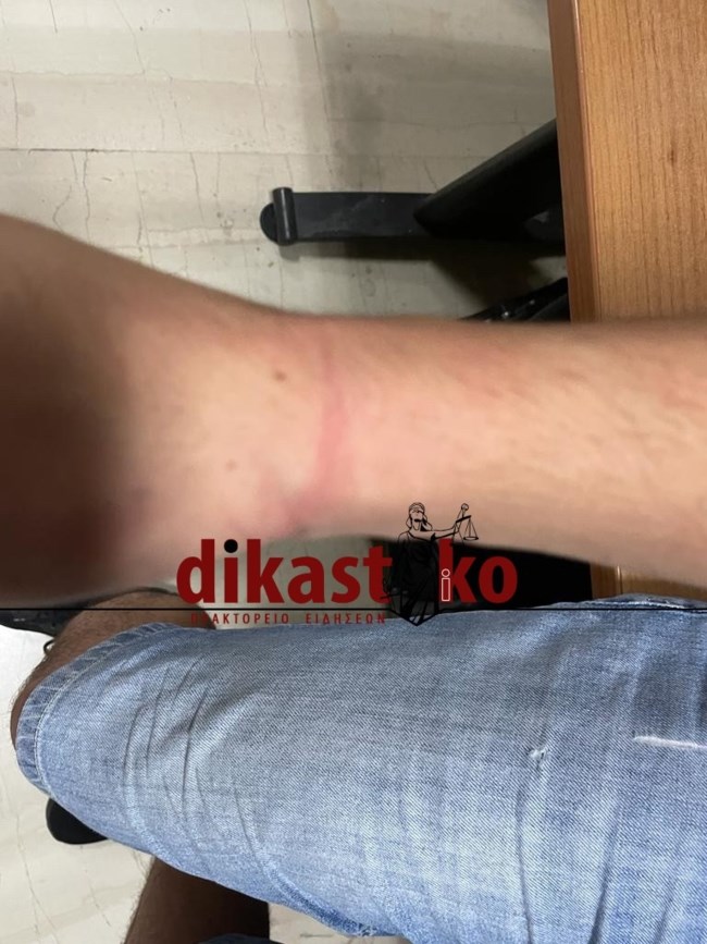 ΕΠΙΘΕΣΗ