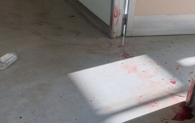 Επίθεση στο Αττικό νοσοκομείο: Συγκλονίζει συνάδελφος της νοσηλεύτριας - "Κλότσησα το χέρι του να φύγει το μαχαίρι" [Βίντεο]