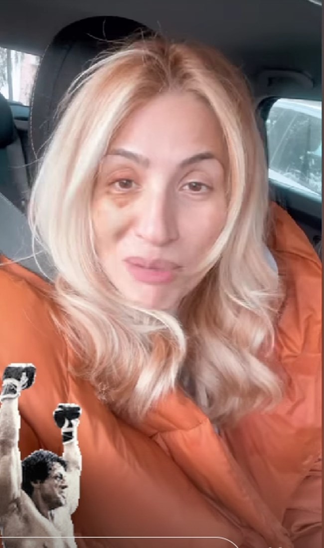 Με μαυρισμένο μάτι η Μαρία Ηλιάκη: "Γι’ αυτό δεν εμφανιζόμουν όλες αυτές τις μέρες"