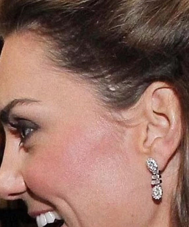 ΚΕΙΤ ΜΙΝΤΛΕΤΟΝ