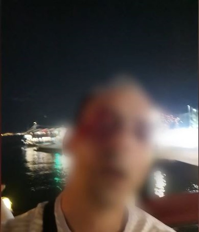Θεσσαλονίκη ξυλοδαρμός