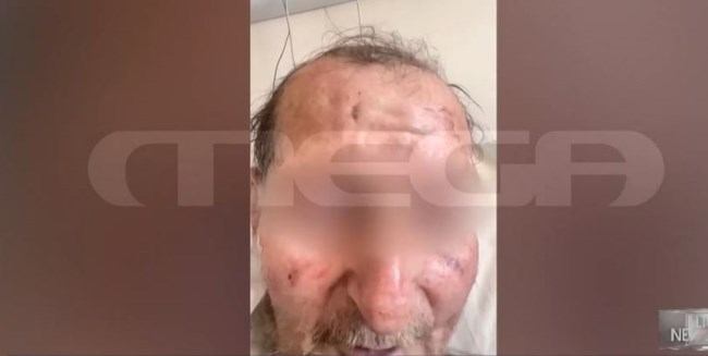 Λαγκαδάς: Αυτός είναι ο 60χρονος που προκάλεσε το τροχαίο με θύμα την 50χρονη Χαρά - "Μακάρι να ήμουν εγώ στη θέση της"