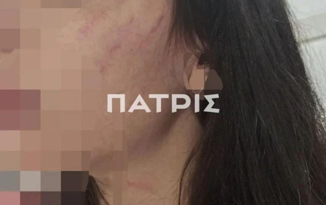 ΚΑΚΟΠΟΙΗΣΗ ΕΔΕΣΣΑ