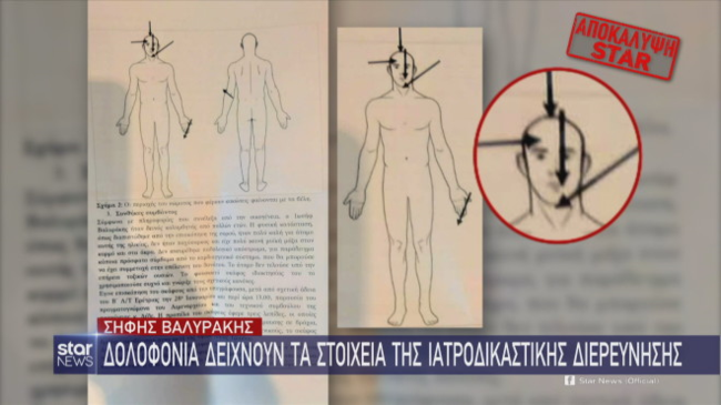 Υπόθεση Βαλυράκη: Το σκίτσο που ρίχνει φως στα αίτια θανάτου - Το πόρισμα και τα τραύματα στο πρόσωπο [βίντεο]
