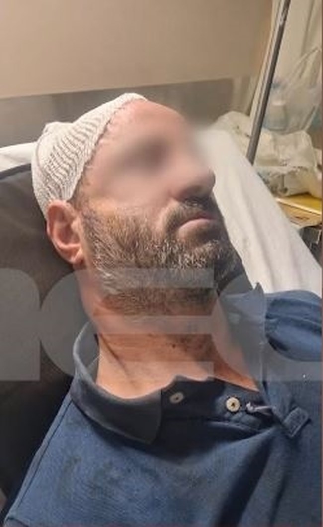 ΑΙΓΑΛΕΩ ΖΕΥΓΑΡΙ