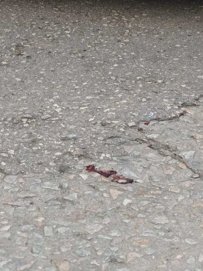 Αιματηρή ληστεία στην Ακρόπολη: Μαχαίρωσαν 18χρονο, διασωληνωμένος, σε κρίσιμη κατάσταση