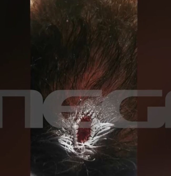 Στέφανος Κοκολογιάννης για την αιματηρή επίθεση: Μου έριξε 10 πυροβολισμούς - Προσπάθησαν και άλλες φορές να με σκοτώσουν