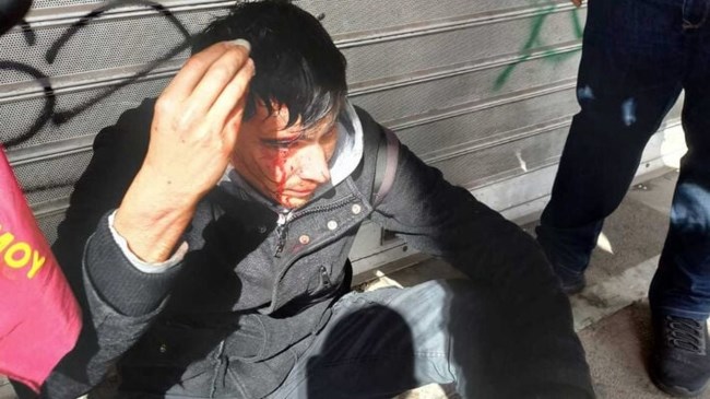 Επεισόδια μεταξύ ΜΑΤ και εργαζομένων του επισιτισμού - Καταγγελίες για τραυματισμούς [εικόνες, βίντεο]