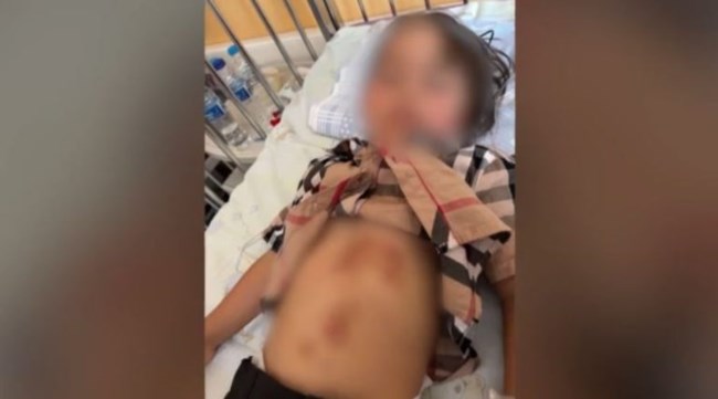 λυκοσ Χαλκιδικη