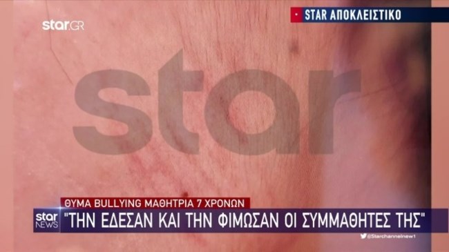 7χρονη