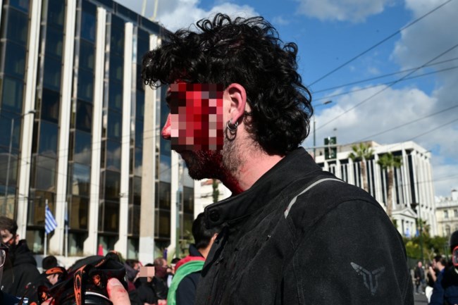 Διατάχθηκε ΕΔΕ από την ΕΛΑΣ για τα άγρια επεισόδια και τους τραυματισμούς φοιτητών