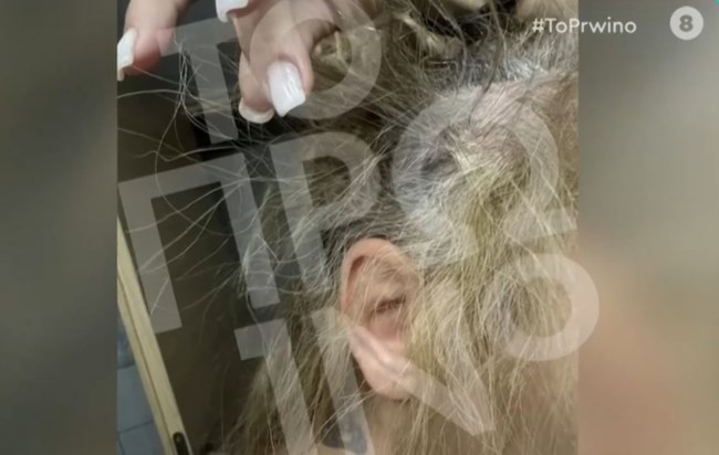 Γνωστός πλαστικός χειρουργός ξυλοκόπησε 43χρονη οδηγό στη Συγγρού - Την άρπαξε από τα μαλλιά και τη χτυπούσε [βίντεο]