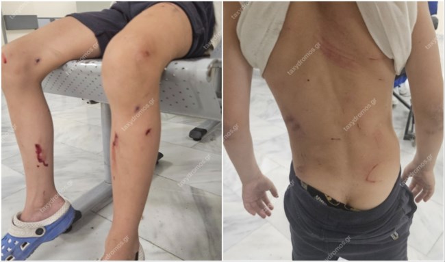 Τρόμος στον Βόλο: Τρία μεγαλόσωμα αδέσποτα σκυλιά παραλίγο να κατασπαράξουν 7χρονο - Σοκαριστική εικόνα