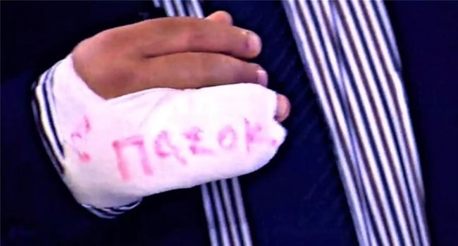 Με γύψο που έγραφε ΠΑΣΟΚ εμφανίστηκε στην εκπομπή ο Γιάννης Ντσούνος του ΣΚΑΙ [εικόνα]