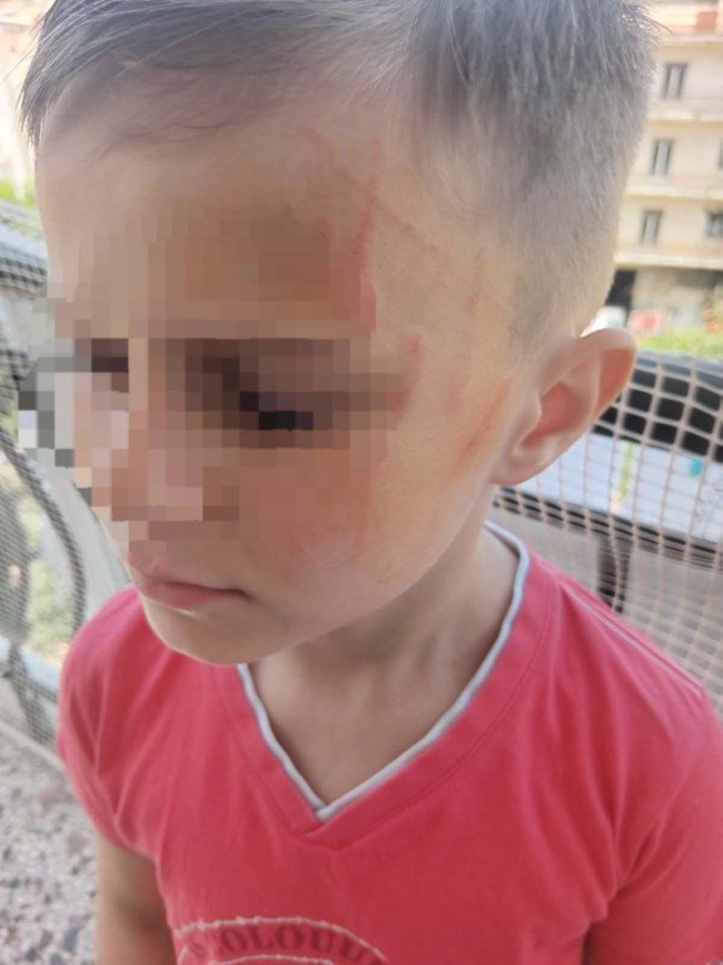 Αγρίνιο: Πεντάχρονος έπεσε θύμα bullying από συμμαθητές του - Του ζήτησαν να βγάλει τα ρούχα του