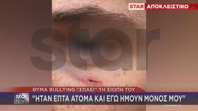 ξυλοδαρμος