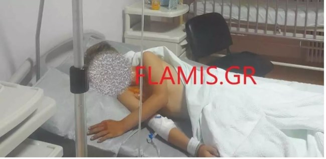 Πάτρα: Με εγκαύματα στο πρόσωπο και στο στήθος 9χρονος από βεγγαλικά σε σχολική γιορτή