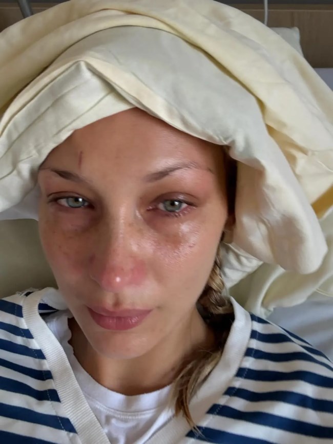 Εξαντλημένη από τη νόσο Lyme η Μπέλα Χαντίντ: Νέες, ανησυχητικές φωτογραφίες του σούπερ μόντελ