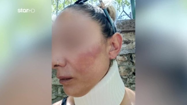 Λέσβος κακοποίηση πυροσβέστης