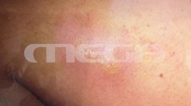 Μαρίσσα Λαιμού: Τα μηνύματα σε φίλη της μέσα από το νοσοκομείο - "Είμαι χάλια, κανείς δεν με έχει τσεκάρει"