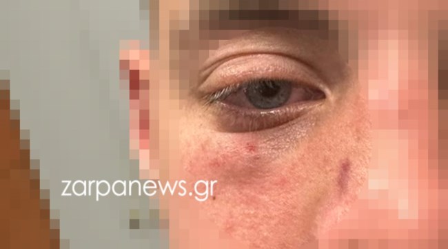Χανιά σινεμά επίθεση