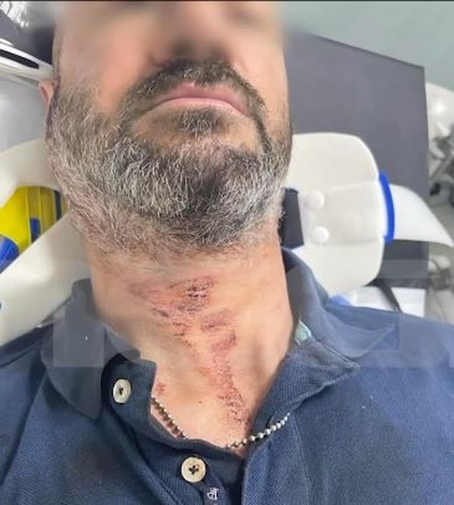 ΑΙΓΑΛΕΩ ΖΕΥΓΑΡΙ