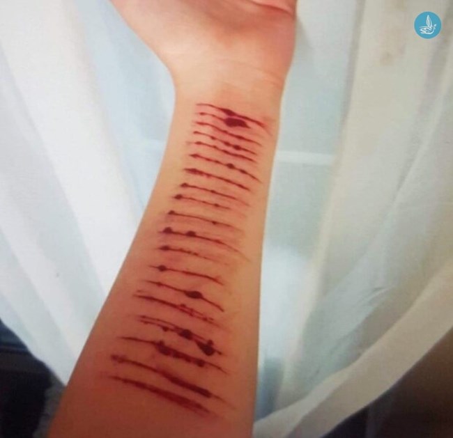 Σοκ στην Ρόδο: Αποπλάνησε 12χρονη μέσω του ίντερνετ για να του στείλει γυμνές φωτογραφίες και να αυτοτραυματιστεί