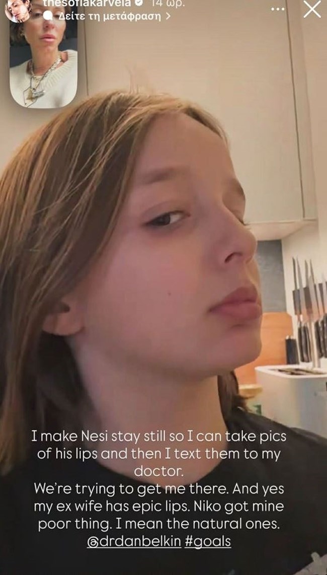 Σοφία Καρβέλα: Η αισθητική παρέμβαση που έκανε στο πρόσωπό της και το πρότυπό της