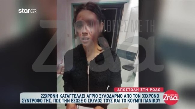 Τριαντάφυλλος: Συγγενής του, θύμα άγριου ξυλοδαρμού από τον σύντροφό της: "Πίστεψα ότι θα με σκότωνε!"