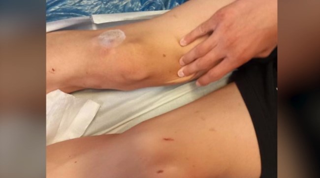 Ξυλοδαρμός Καλαμάτα