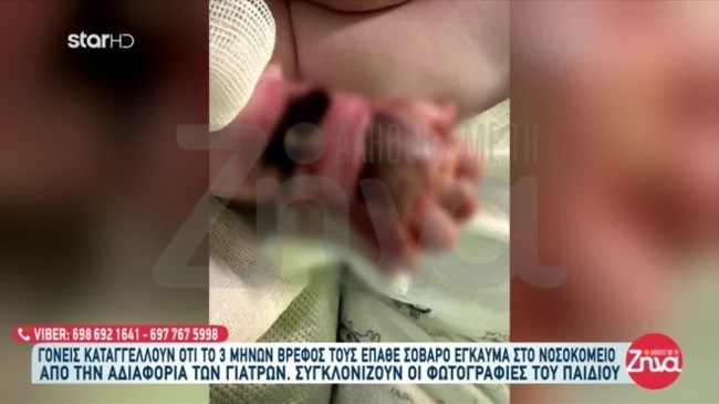 Βόλος: Βρέφος τριών μηνών έπαθε έγκαυμα στο χέρι από ορό σε νοσοκομείο - Κινδυνεύει με νέκρωση του άκρου - Διατάχθηκε ΕΔΕ