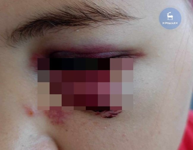 Ρόδος - Ξυλοδαρμός 13χρονης