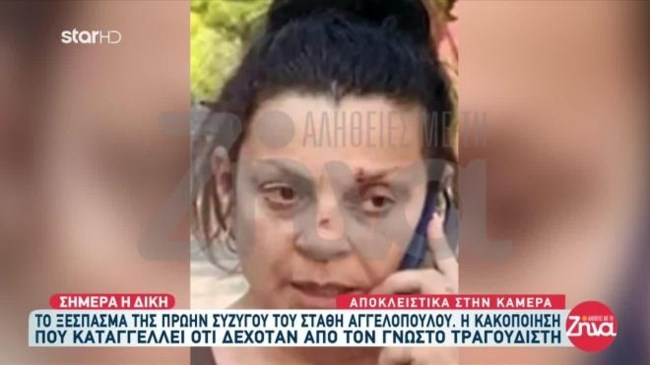 Στάθης Αγγελόπουλος: "Έφαγα πολύ ξύλο και δεν ξέρω τον λόγο" λέει η πρώην σύζυγός του - "Να προσέχει τι λέει" απαντά ο τραγουδιστής