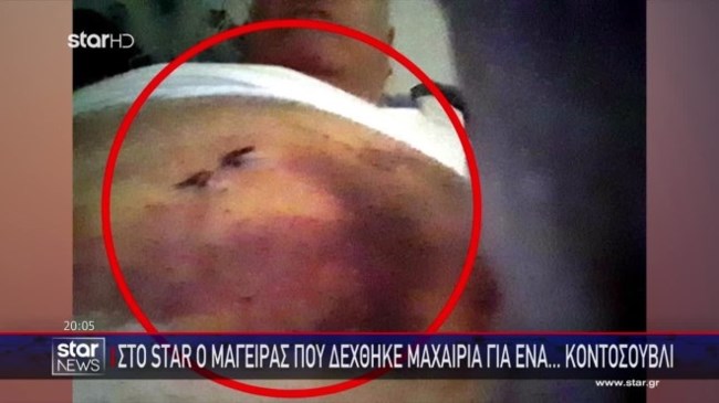 "Έχασα 2,5 λίτρα αίμα", λέει σοκαρισμένος ο μάγειρας που μαχαιρώθηκε  από πελάτη που δεν του άρεσε το... κοντοσούβλι