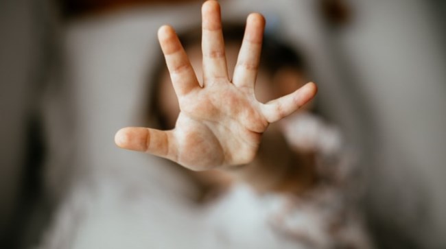 Συγκλονίζει η 28χρονη που κρεμάστηκε από μπαλκόνι για να γλιτώσει από τον σύντροφό της - "Του φώναζα μη με χτυπάς"