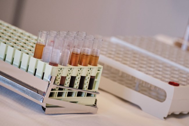 ΜΗΤΣΟΤΑΚΗΣ - ΕΚΕΑ