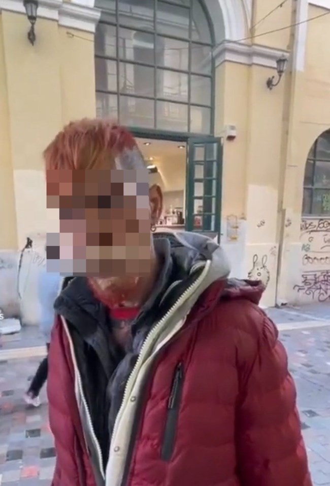 Αθήνα: Αυτός είναι ο 57χρονος που παρενόχλησε σεξουαλικά τα δύο ανήλικα κορίτσια - Τα θώπευσε και τα φίλησε