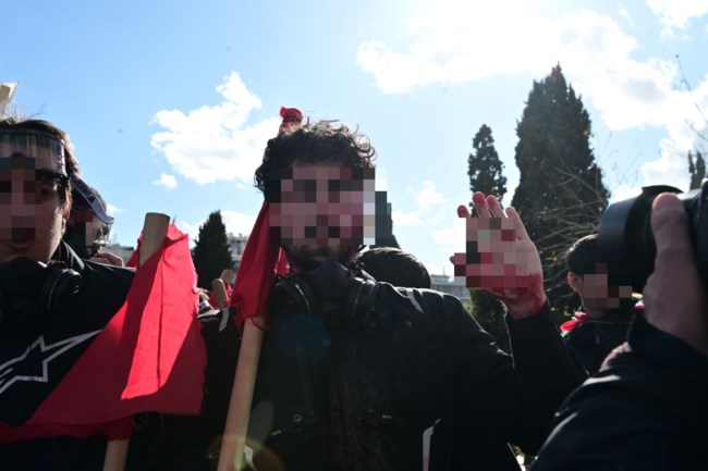 ΕΠΕΙΣΟΔΙΑ ΤΡΑΥΜΑΤΙΕΣ