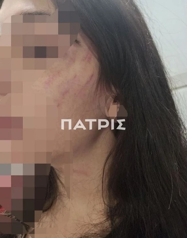 ΚΑΚΟΠΟΙΗΣΗ ΕΔΕΣΣΑ
