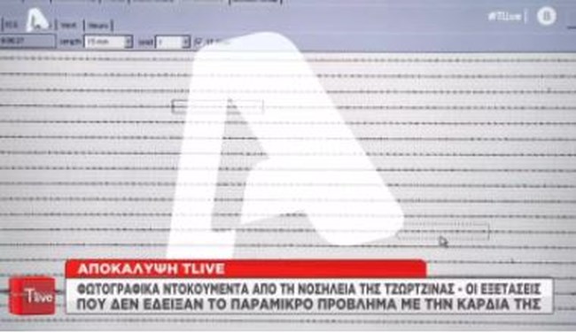 tzvrtziba
