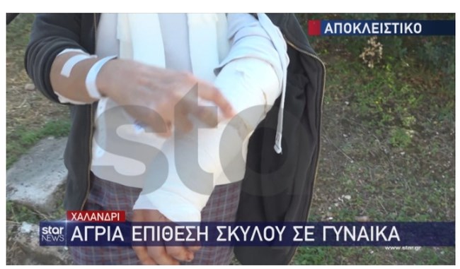 Χαλάνδρι: Γυναίκα δέχθηκε επίθεση από σκύλο ενώ έκανε τζόκινγκ - "Μου έφυγε το κρέας"