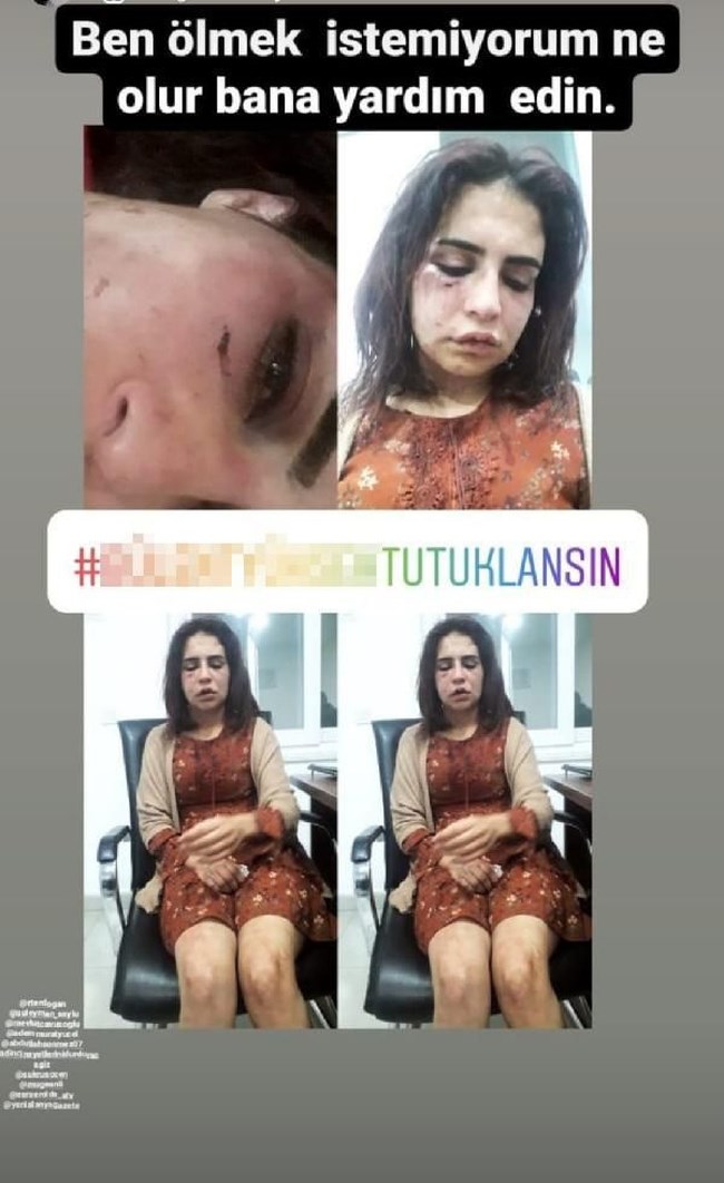 Τούρκος βιντεοσκόπησε τον ξυλοδαρμό της ερωμένης του για να ζητήσει συγγνώμη από τη σύζυγό του [Εικόνες]