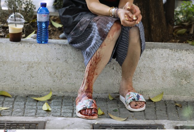 ΖΩΓΡΑΦΟΥ ΕΠΙΘΕΣΗ