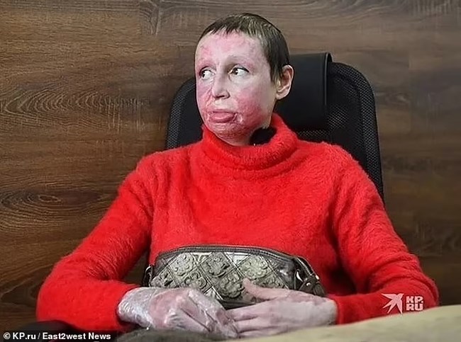 Αδιανόητη φρίκη: Τη σταύρωσε και της έβαλε φωτιά επειδή του ζήτησε να χωρίσουν - Στο δικαστήριο της έλεγε "Σ'αγαπώ"