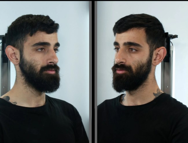 Μέλη σπείρας
