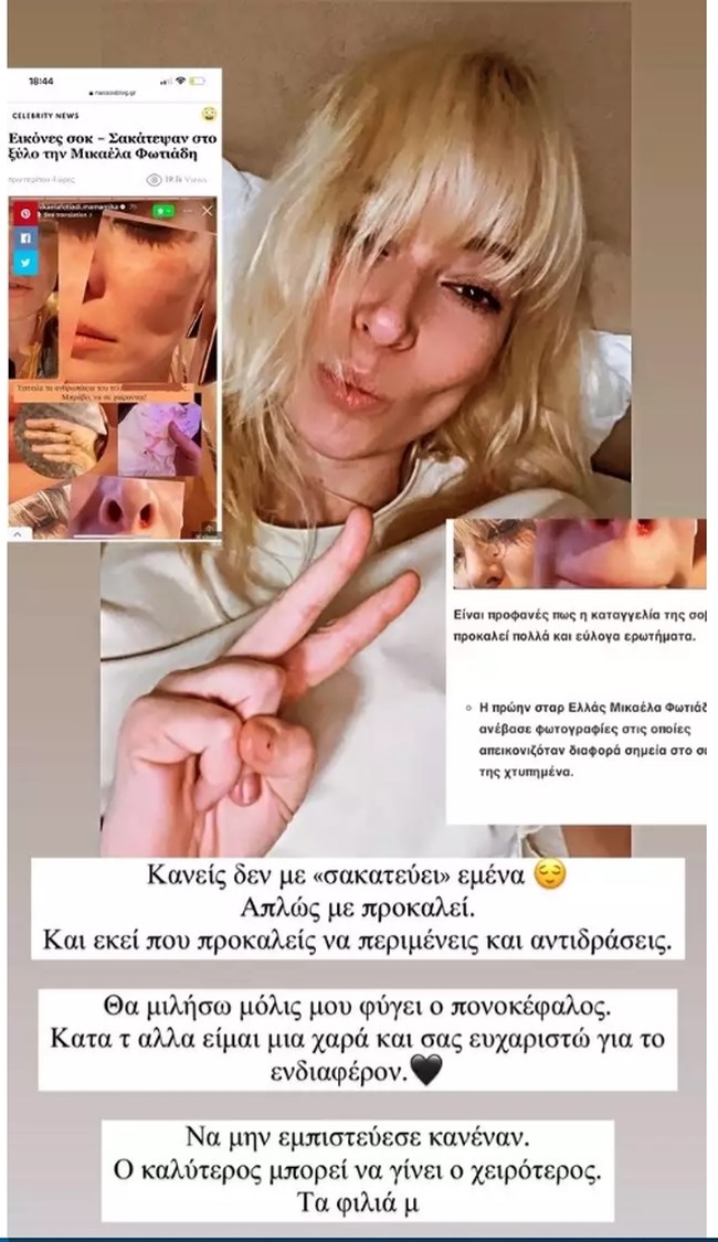 φωτιαδη