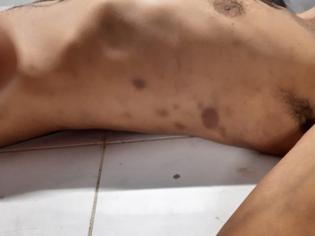 Σάλος με τον θάνατο μετανάστη στο ΑΤ Άγ. Παντελεήμονα - Στον Συνήγορο του Πολίτη η έρευνα της υπόθεσης