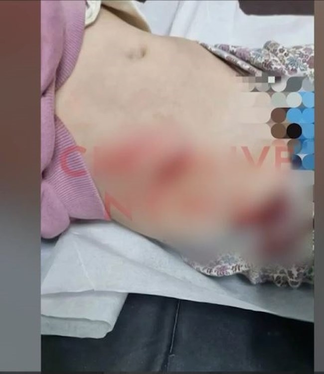 Ηράκλειο: Παρολίγον τραγωδία με κοριτσάκι 4,5 χρόνων - Επεσε σε φρεάτιο γεμάτο σκουπίδια και κοφτερές λαμαρίνες