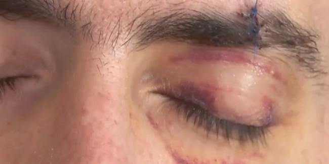 ξυλοδαρμός Θεσσαλονίκη